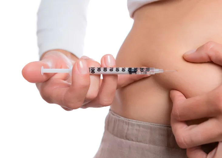 Puntura decapeptyl Puntura decapeptyl