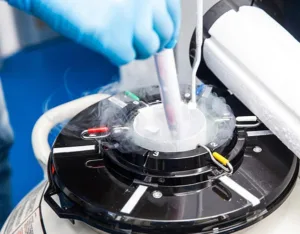 Criovonservazione gameti